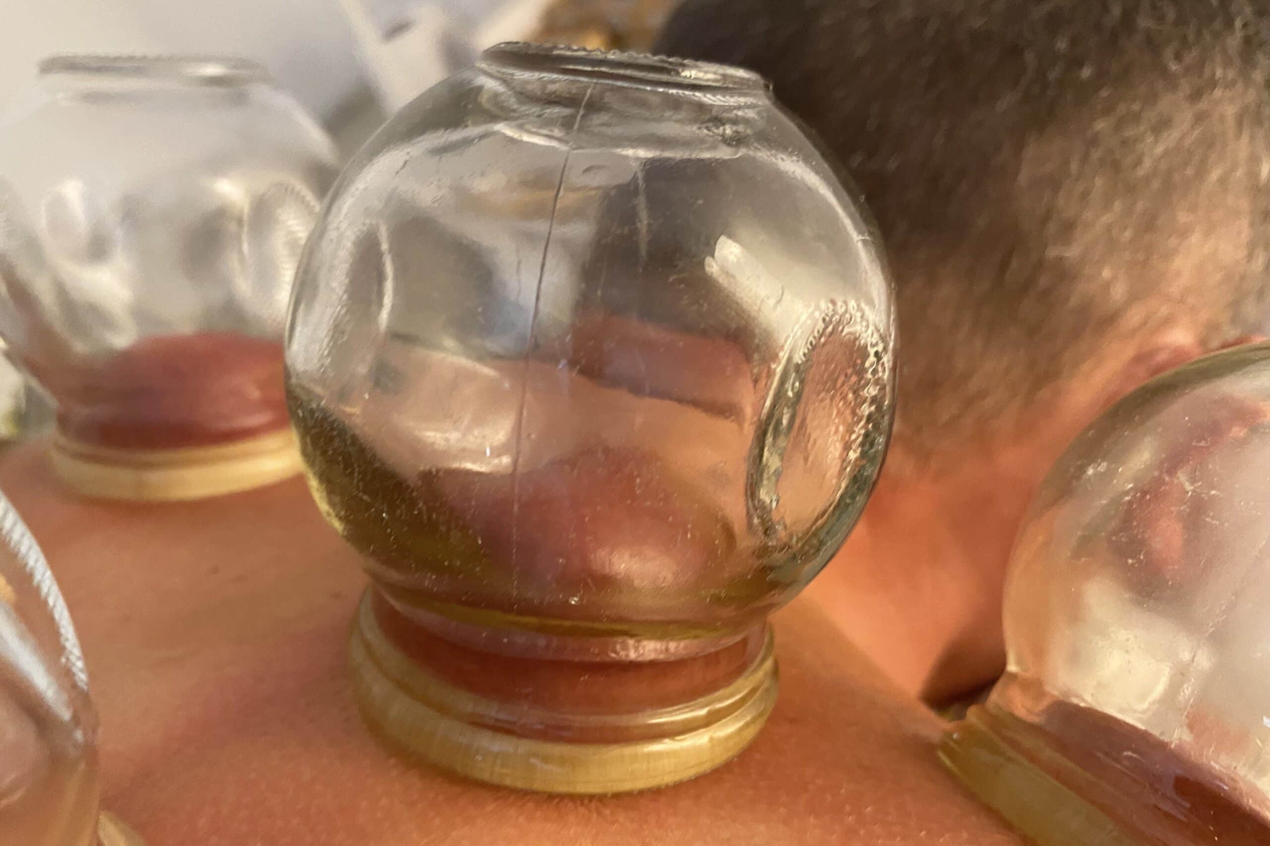 ventouse-nicolas-charlet-cupping-3